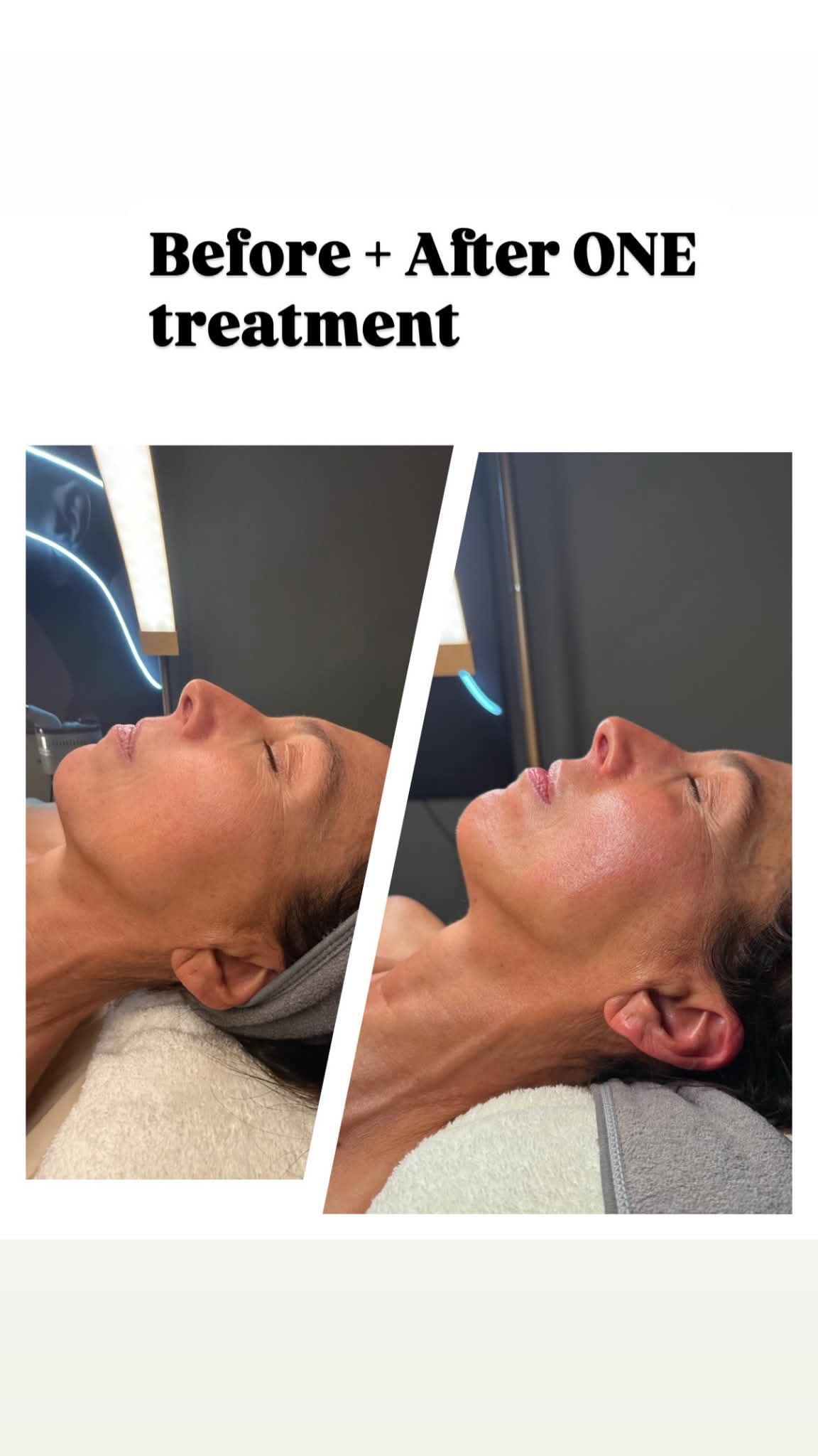 MLAesthetics client skin result