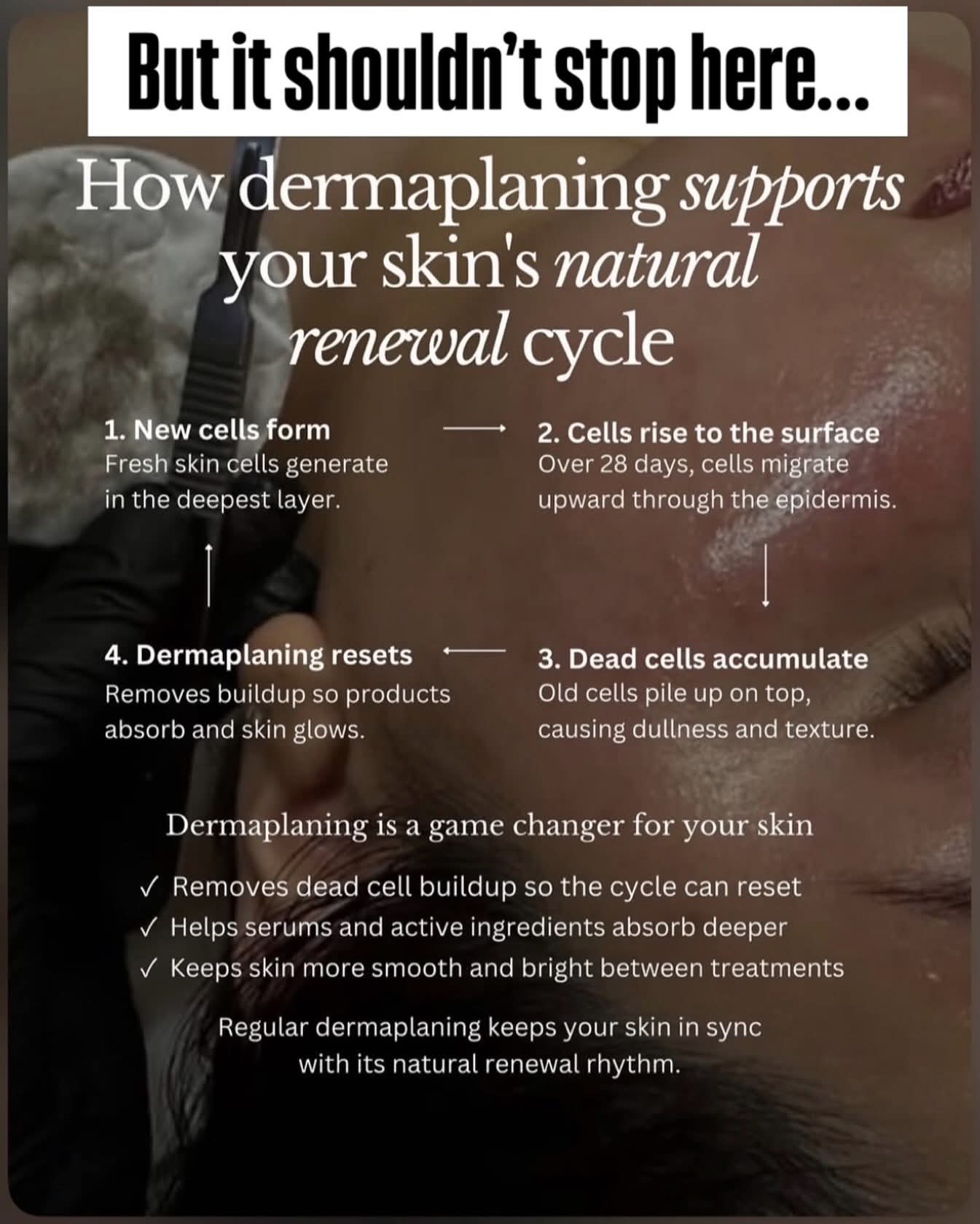 MLAesthetics dermaplaning education